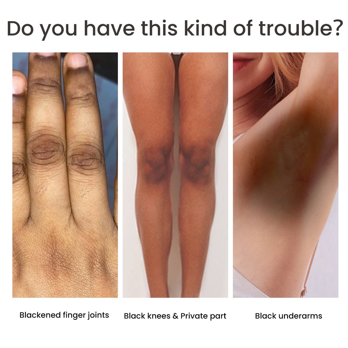Women's Skin Pigmentation