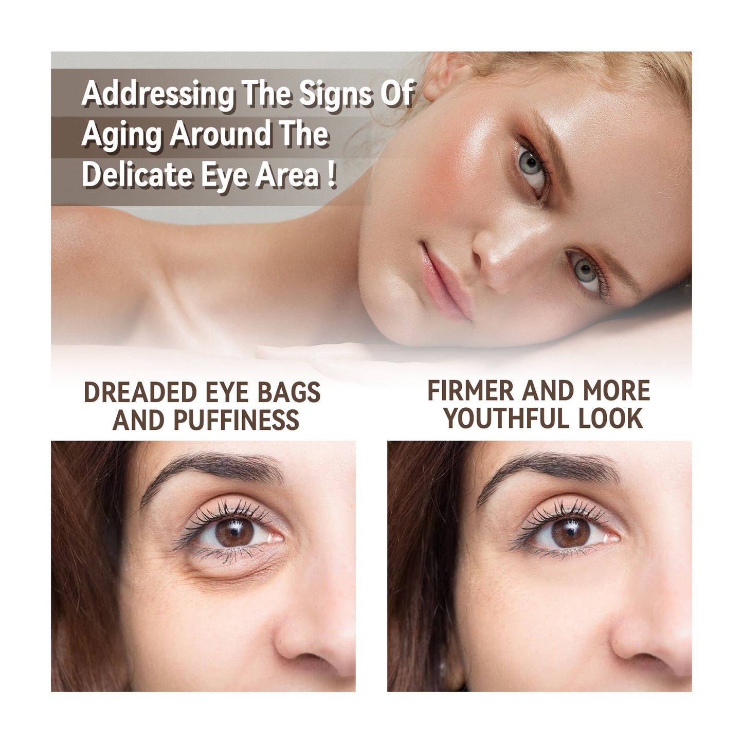 Moisturizing Eye Skin