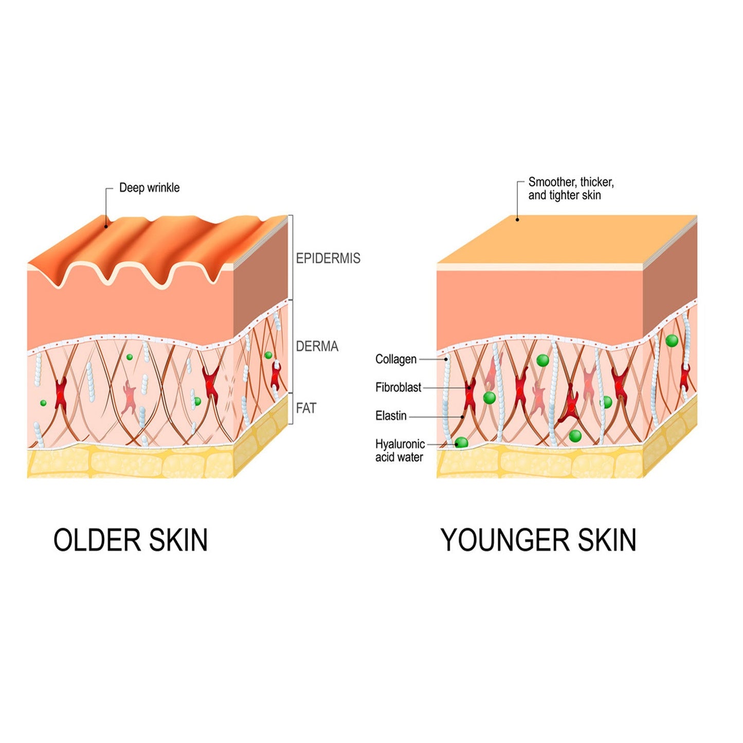 Anti-wrinkle