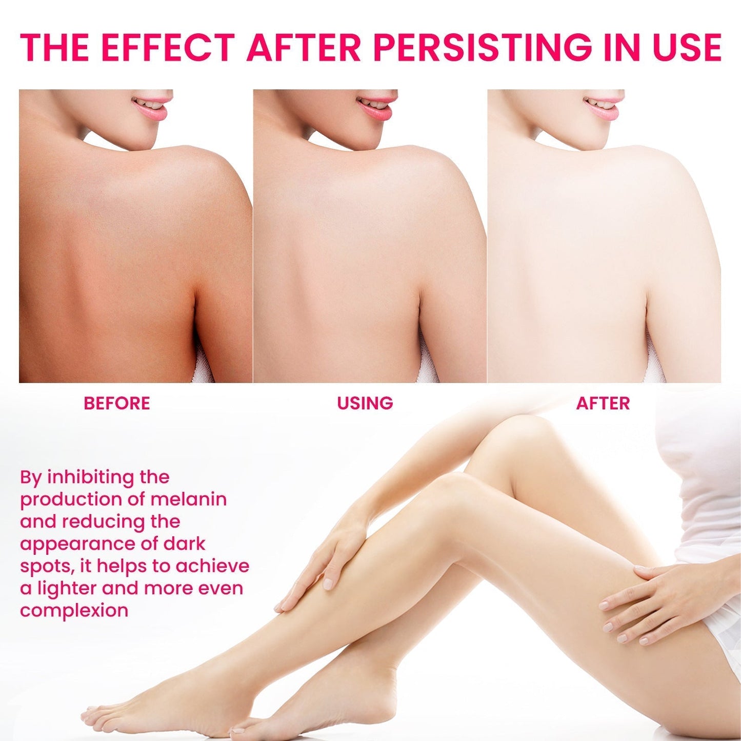 Women's Skin Pigmentation